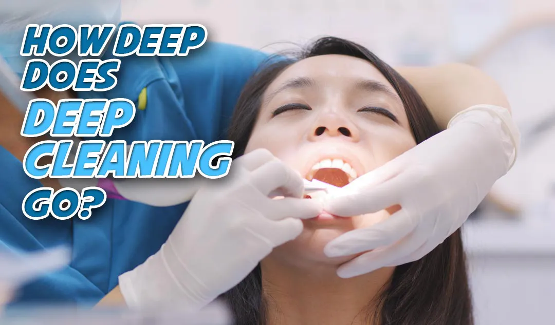 What’s the difference between deep cleaning and regular cleaning at the dentist?