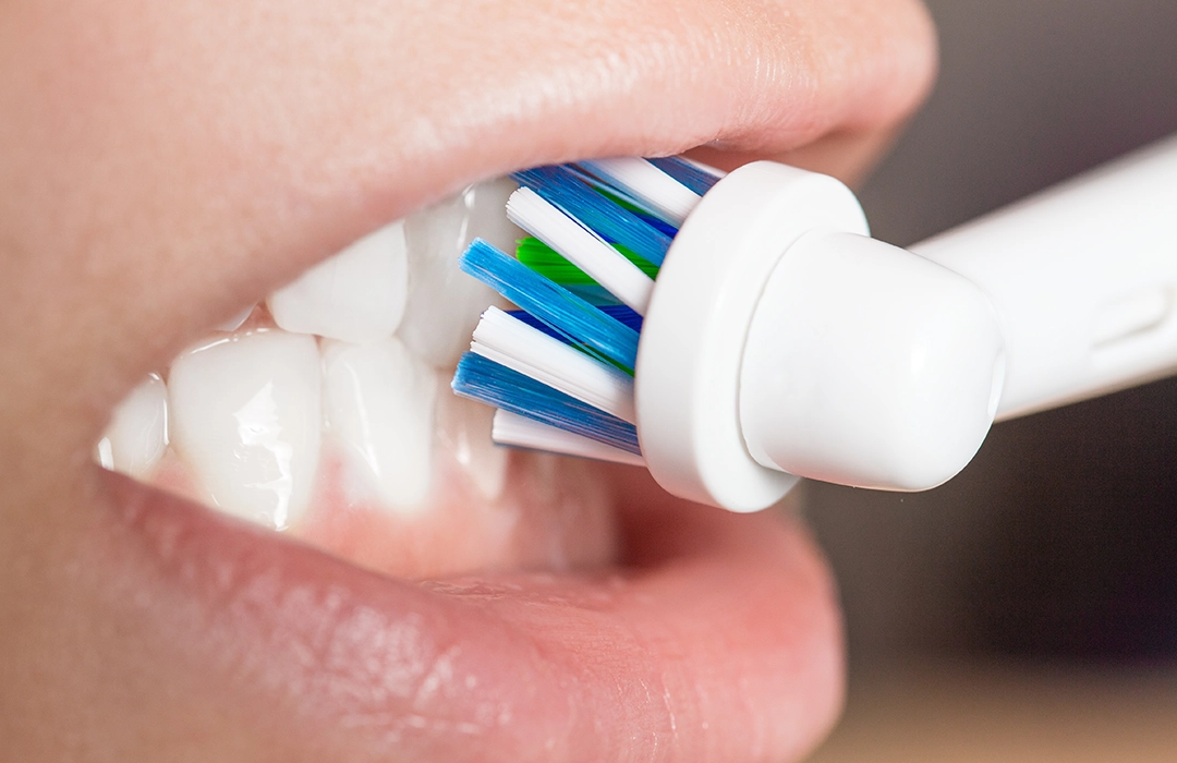 Are you brushing too aggressively